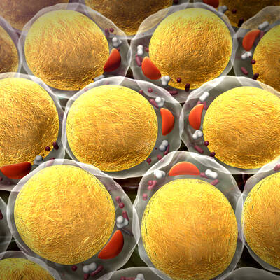 Enlarged fat cells can cause metabolic diseases