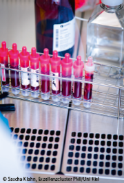 Bei 9 von 13 untersuchten chronischen Entzündungserkrankungen waren die Tryptophankonzentrationen im Blut signifikant reduziert. © Sascha Klahn, Exzellenzcluster PMI/Uni Kiel Bei 9 von 13 untersuchten chronischen Entzündungserkrankungen waren die Tryptophankonzentrationen im Blut signifikant reduziert. © Sascha Klahn, Exzellenzcluster PMI/Uni Kiel