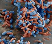 Lactobacillus reuteri (blau) verklumpt und inaktiviert den Magenkeim Helicobacter pylori (rot) – hier 11000-fach vergrößert. © Organobalance Lactobacillus reuteri (blau) verklumpt und inaktiviert den Magenkeim Helicobacter pylori (rot) – hier 11000-fach vergrößert. © Organobalance