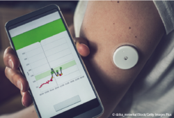 Die Handhabung der automatisierten Insulindosierungssysteme erfordert eine ausführliche und therapiebegleitende Schulung, sonst ist der gewünschte positive Effekt auf den Blutglukosespiegel gefährdet. © dzika_mrowka/iStock/Getty Images Plus Am Oberarm befestigtes Insulindosierungssystem und Mobiltelefon. © dzika_mrowka/iStock/Getty Images Plus