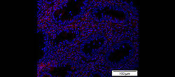 Das Protein Bcl-3 (rot) führt zu chronischen Entzündungen im Darm. © Universitätsmedizin Mainz Das Protein Bcl-3 (rot) führt zu chronischen Entzündungen im Darm. © Universitätsmedizin Mainz