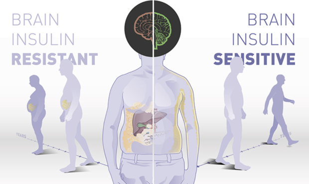 Die Insulinwirkung im Gehirn bestimmt Körpergewicht und Fettverteilung – und wie man auf Lebensstilinterventionen reagiert. © IDM, DZD