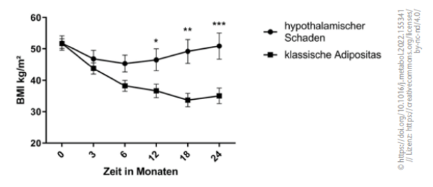Gewichtsverlauf der PatientInnen mit hypothalamischem Schaden und klassischer Adipositas nach bariatrischer Chirurgie: Der Gewichtsverlauf unterscheidet sich sehr deutlich. In der ersten Gruppe ist kein dauerhafter gewichtsreduzierender Effekt zu sehen.