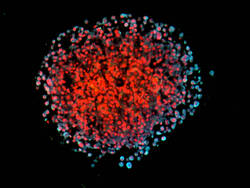3D-Spheroid von Brustkrebszellen in Kultur. Die invasiven (metastasierenden) Zellen erscheinen durch überlappende Fluoreszensmarkierung des Leptin-Rezeptors und eines Metastasierungsmarkers hellblau. Zellkerne sind rot gefärbt. © Helmholtz Zentrum München