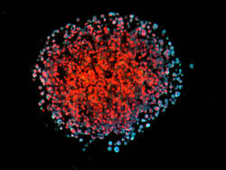3D-Spheroid von Brustkrebszellen in Kultur. Die invasiven (metastasierenden) Zellen erscheinen durch überlappende Fluoreszensmarkierung des Leptin-Rezeptors und eines Metastasierungsmarkers hellblau. Zellkerne sind rot gefärbt. © Helmholtz Zentrum München