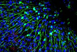 Die Kontraktionen des Körpers werden von Nervenzellen (in grün) ausgelöst; Bakterien (in rot) greifen dabei in den Regelmechanismus der diesem Ablauf zugrundeliegenden Schrittmacherzellen ein. © Christoph Giez, Dr. Alexander Klimovich